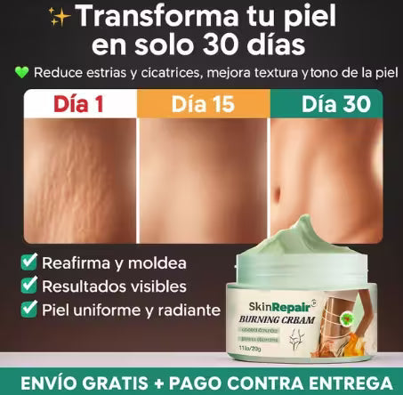 Crema Antiestrias Skinrepair    😱 Adiós estrías y celulitis… ¡hola piel firme y lisa! ✨